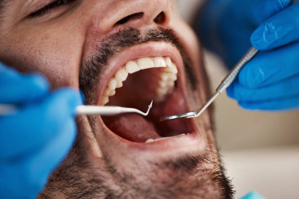 Full Mouth Reconstruction in Montevallo, AL